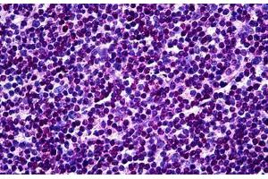 Human Tonsil: Formalin-Fixed, Paraffin-Embedded (FFPE)