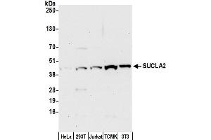 anti-Succinate-CoA Ligase, ADP-Forming, beta Subunit (SUCLA2) (AA 50-100) antibody