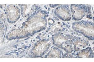 ABIN6269324 at 1/100 staining Human prostate tissue by IHC-P. (LIPE anticorps  (Internal Region))