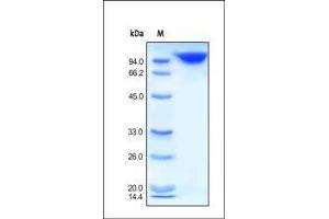 SDS-PAGE (SDS) image for Dipeptidyl-Peptidase 4 (DPP4) (AA 29-766) protein (Fc Tag) (ABIN2180984)