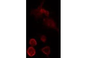 ABIN6275724 staining  HeLa cells by IF/ICC. (MED27 anticorps  (Internal Region))
