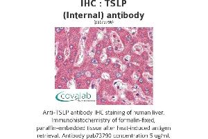 Image no. 2 for anti-Thymic Stromal Lymphopoietin (TSLP) (Internal Region) antibody (ABIN1740422) (Thymic Stromal Lymphopoietin anticorps  (Internal Region))
