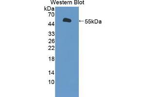 Western blot analysis of the recombinant protein. (BPIFA1 anticorps  (AA 20-256))