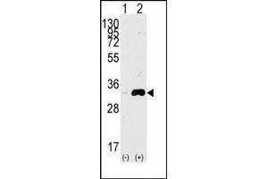 Western blot analysis of CDK1(arrow) using rabbit polyclonal CDK1 Antibody. (CDK1 anticorps  (Thr14))