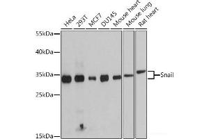 Western blot analysis of extracts of various cell lines using Snail Polyclonal Antibody at dilution of 1:1000. (SNAIL anticorps)