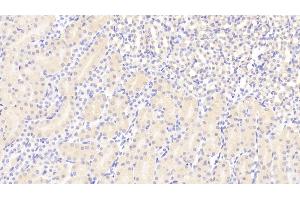 Detection of ACE2 in Mouse Kidney Tissue using Polyclonal Antibody to Angiotensin I Converting Enzyme 2 (ACE2)