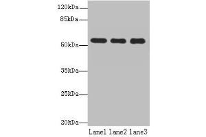Western blot All lanes: TBC1D22A antibody at 18 μg/mL Lane 1: Colo320 whole cell lysate Lane 2: HepG2 whole cell lysate Lane 3: Rat skeletal muscle tissue Secondary Goat polyclonal to rabbit IgG at 1/10000 dilution Predicted band size: 60, 51, 37, 54 kDa Observed band size: 60 kDa (TBC1D22A anticorps  (AA 1-280))
