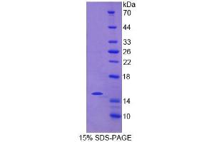 SDS-PAGE analysis of Human NCR2 Protein. (NKp44/NCR2 Protéine)