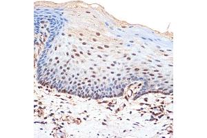 Immunohistochemistry of paraffin-embedded human esophageal using B Rabbit mAb (ABIN7265826) at dilution of 1:100 (40x lens).