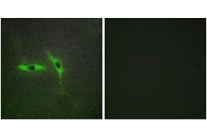 Immunofluorescence analysis of HepG2 cells, using TNFRSF6B Antibody. (TNFRSF6B anticorps  (AA 251-300))