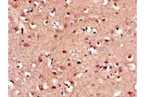 Immunohistochemistry of paraffin-embedded human brain tissue using ABIN7153193 at dilution of 1:100 (FZD8 anticorps  (AA 55-233))