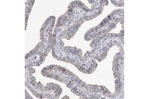 Immunohistochemical staining of human fallopian tube with KIF26B polyclonal antibody  shows distinct positivity in ciliated cells at 1:50-1:200 dilution.