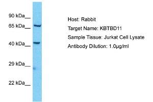 Host: Rabbit Target Name: KBTBD11 Sample Type: Jurkat Whole Cell lysates Antibody Dilution: 1. (KBTBD11 anticorps  (Middle Region))