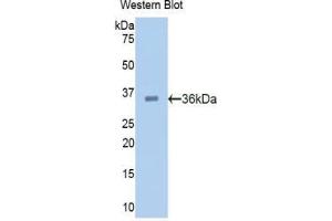 Western blot analysis of the recombinant protein. (PCSK9 anticorps  (AA 156-461))