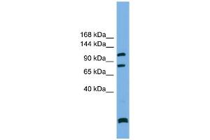 WB Suggested Anti-PPP6R1  Antibody Titration: 0. (SAPS1 anticorps  (N-Term))