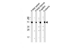 All lanes : Anti-IGHG1 Antibody (Center) at 1:2000 dilution Lane 1: human fetal spleen lysate Lane 2: human fetal thymus lysate Lane 3: human spleen lysate Lane 4: human plasma lysate Lysates/proteins at 20 μg per lane.