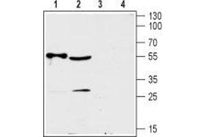 Western blot analysis of rat heart (lanes 1 and 3) and mouse brain (lanes 2 and 4) lysates:  - 1,2. (SLC29A2 anticorps  (3rd Intracellular Loop))