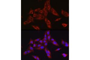 Immunofluorescence analysis of U-2 OS cells using Furin Rabbit pAb (ABIN6127933, ABIN6140815, ABIN6140817 and ABIN6223322) at dilution of 1:150 (40x lens). (FURIN anticorps  (AA 120-370))
