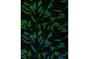 Immunofluorescence analysis of L929 cells using TIMM8B Polyclonal Antibody (ABIN7270928) at dilution of 1:100 (40x lens).