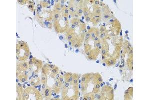 Immunohistochemistry of paraffin-embedded Human stomach using DYNC1I1 Polyclonal Antibody at dilution of 1:100 (40x lens).