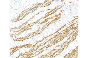 Immunohistochemistry (IHC) image for anti-Troponin I (TNNI) (AA 1-50) antibody (ABIN7795679)