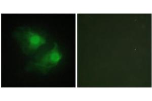 Immunofluorescence analysis of HeLa cells, using LIMK2 antibody. (LIMK2 anticorps  (Internal Region))