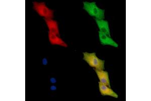ABIN7096225 and ABIN7100287 staining  cells by IF/ICC. (DSCR3 anticorps)