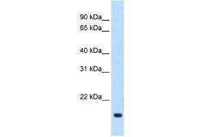 WB Suggested Anti-Rgs2 Antibody Titration:  1. (RGS2 anticorps  (Middle Region))