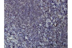 Immunoperoxidase of monoclonal antibody to EPHB3 on formalin-fixed paraffin-embedded human tonsil. (EPH Receptor B3 anticorps  (AA 899-997))