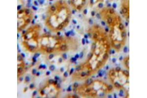 Used in DAB staining on fromalin fixed paraffin-embedded kidney tissue