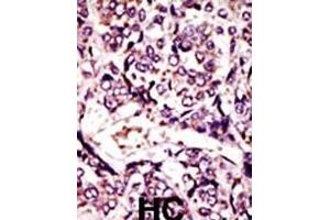 anti-ADP Ribosylation Factor Like GTPase 1 (ARL1) (AA 1-30), (N-Term) antibody
