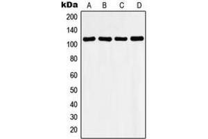 Western blot analysis of Histone Deacetylase 9 expression in LO2 (A), mouse heart (B), rat heart (C), Ramos (D) whole cell lysates. (HDAC9 anticorps  (C-Term))