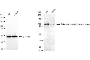 Western blotting analysis using Eukaryotic elongation factor 2 kinase antibody (ABIN7798497).