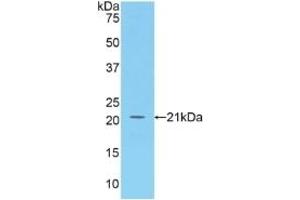 Detection of Recombinant BAFF, Human using Polyclonal Antibody to B-Cell Activating Factor (BAFF)