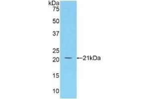 Detection of Recombinant BAFF, Human using Polyclonal Antibody to B-Cell Activating Factor (BAFF) (BAFF anticorps  (AA 113-283))