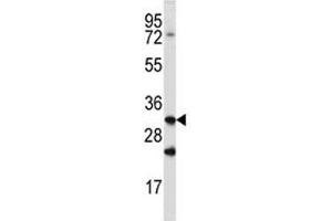 Cathepsin Q antibody western blot analysis in mouse spleen tissue lysate (Cathepsin Q anticorps  (AA 192-221))