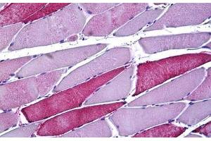 Human Skeletal Muscle: Formalin-Fixed, Paraffin-Embedded (FFPE) (TFAM anticorps  (AA 131-180))