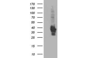 Western Blotting (WB) image for anti-HSPA Binding Protein, Cytoplasmic Cochaperone 1 (HSPBP1) antibody (ABIN1498757) (HSPBP1 anticorps)