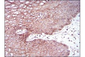 Immunohistochemical analysis of paraffin-embedded esophageal tissues using DSG3 mouse mAb with DAB staining.