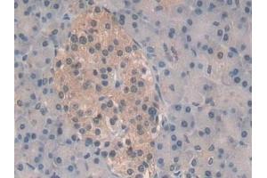 Detection of PSMb6 in Human Pancreas Tissue using Polyclonal Antibody to Proteasome Subunit Beta Type 6 (PSMb6)