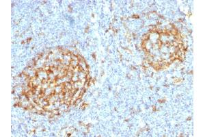 Formalin-fixed, paraffin-embedded human Lymph Node stained with CD14 Mouse Monoclonal Antibody (LPSR/2397).