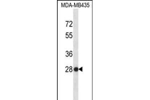 SNRPB2 Antibody (N-term) (ABIN656315 and ABIN2845618) western blot analysis in MDA-M cell line lysates (35 μg/lane). (SNRPB2 anticorps  (N-Term))