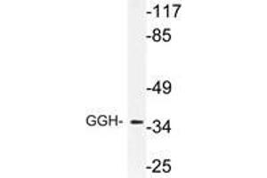 Western blot (WB) analysis of GGH antibody in extracts from RAW264. (GGH anticorps)