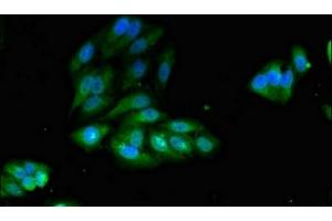 Immunofluorescent analysis of Hela cells using ABIN7156336 at dilution of 1:100 and Alexa Fluor 488-congugated AffiniPure Goat Anti-Rabbit IgG(H+L)