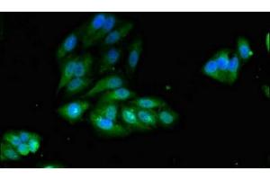 Immunofluorescent analysis of Hela cells using ABIN7156336 at dilution of 1:100 and Alexa Fluor 488-congugated AffiniPure Goat Anti-Rabbit IgG(H+L) (IRS2 anticorps  (AA 766-1001))