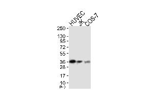 Western blot analysis of extracts from HUVEC cells (Lane 1), JK cells (Lane 2) and COS-7 cells (Lane 3), using MCL1 Antibody. (MCL-1 anticorps)