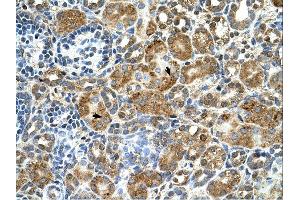 Cystatin B antibody was used for immunohistochemistry at a concentration of 4-8 ug/ml.