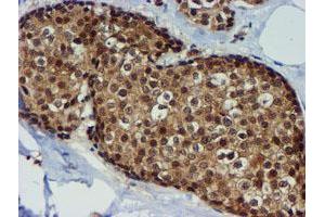 Image no. 9 for anti-Metalloproteinase Inhibitor 2 (TIMP2) antibody (ABIN1501393) (TIMP2 anticorps)