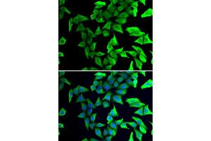 Immunofluorescence analysis of U2OS cells using VSNL1 antibody (ABIN1875337). (VSNL1 anticorps)
