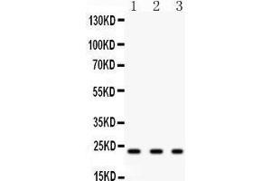 Anti-GST3/GST pi antibody,Western blotting All lanes: Anti GST3/GST pi  at 0. (GSTP1 anticorps  (N-Term))
